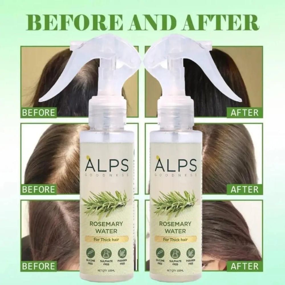 Rosemary Water Hair Spray For Regrowth- Buy 1 Get 2 Free