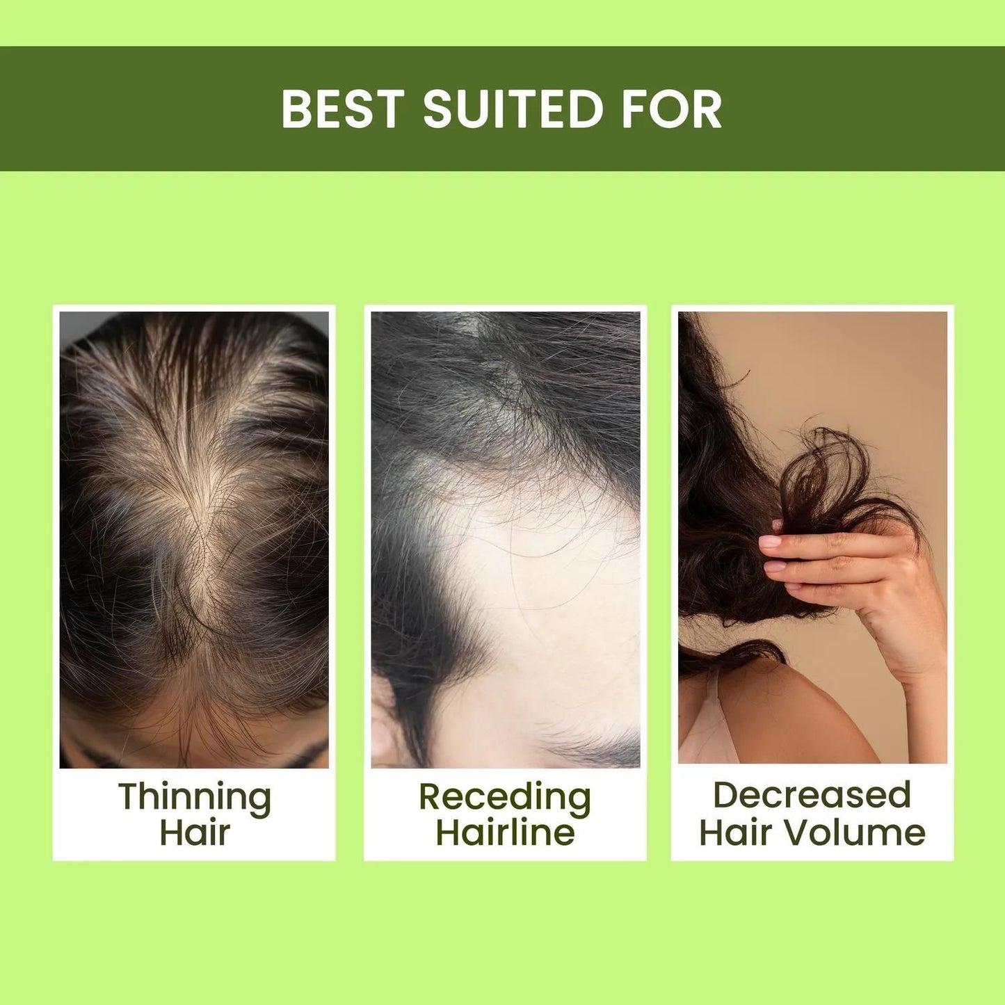 Rosemary Water Hair Spray For Regrowth- Buy 1 Get 2 Free