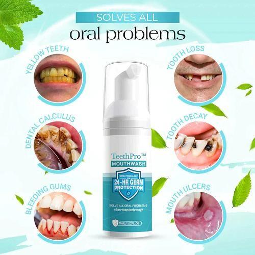 Teeth Whitening Foam (Pack of 2)